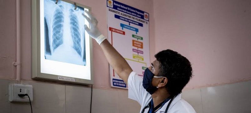 J&K Sees Dramatic Drop In TB Cases  