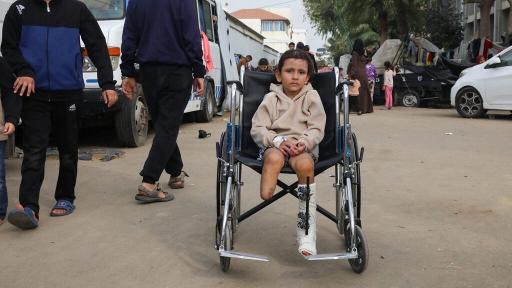 Ten Children Per Day In Gaza Have Their Legs Amputated: UNRWA