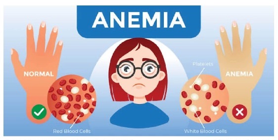 Anaemia is More Than Fatigue